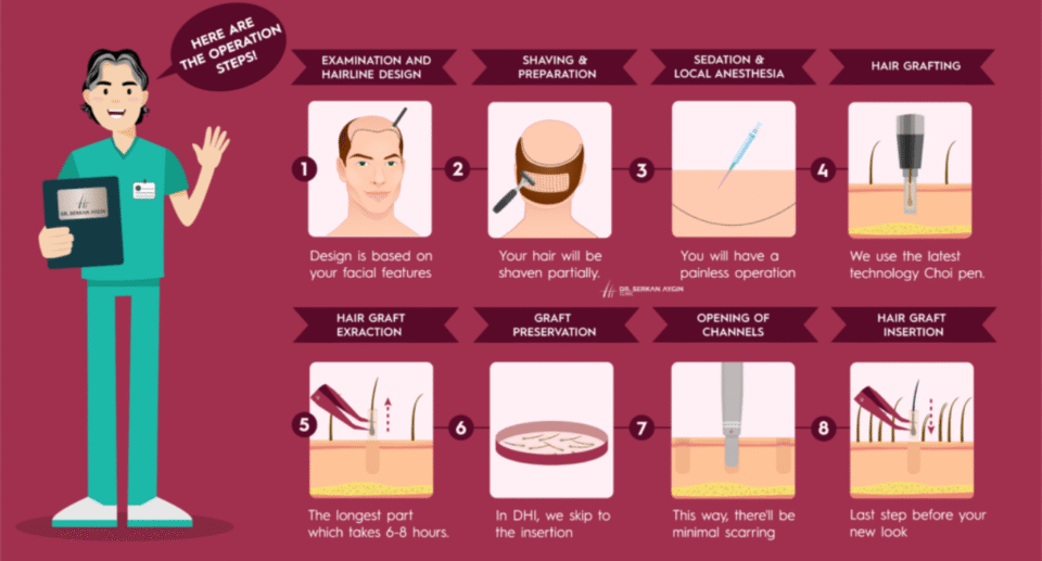Hair Transplants