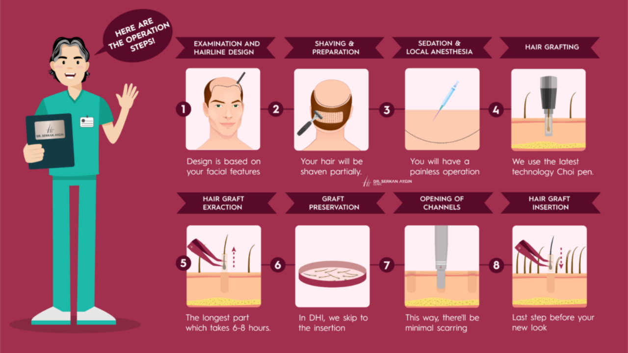 Hair Transplants: A Step-by-Step Guide to the Process